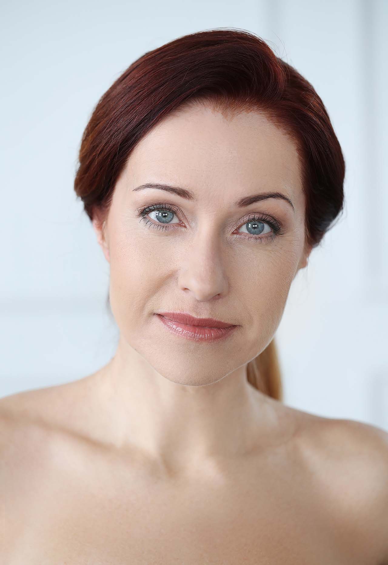 Botox and fillers help erase lines on woman Botox and fillers treatment effectively reduces facial lines for a youthful look.