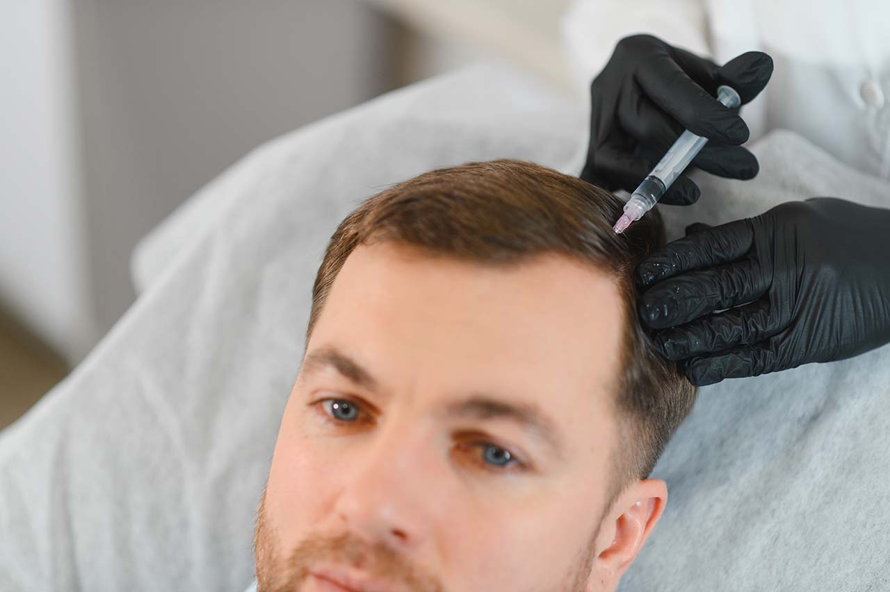 Man receiving PRP injection for effective hair growth restoration.
